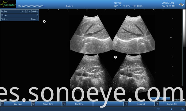 image for labtop ultrasound